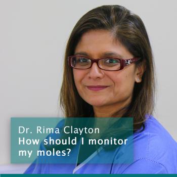 How to Monitor your Moles