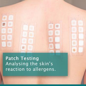 Patch Test