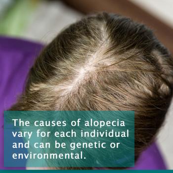 Alopecia