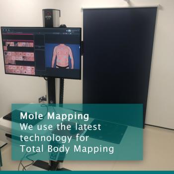 Mole Mapping