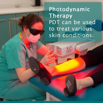 Photodynamic Therapy