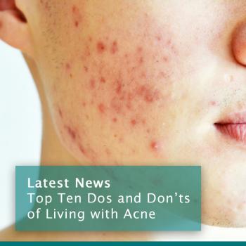 Acne Dos & Don'ts