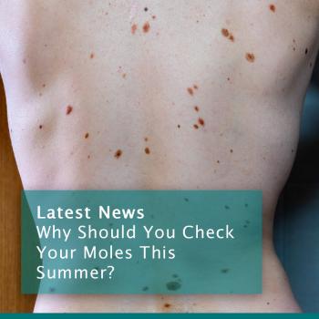 Summer Moles